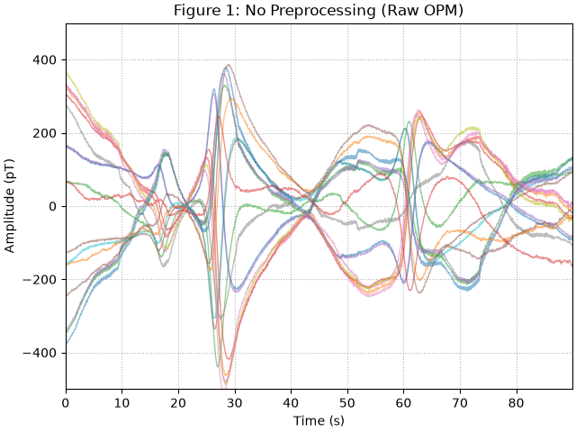 Figure 1: No Preprocessing (Raw OPM)