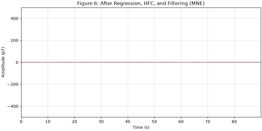 Figure 6: After Regression, HFC, and Filtering (MNE)