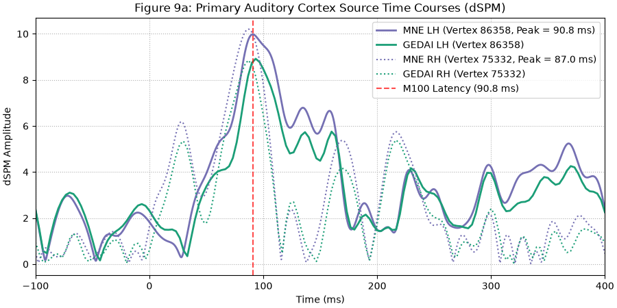 Figure 9a: Primary Auditory Cortex Source Time Courses (dSPM)