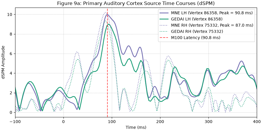 Figure 9a: Primary Auditory Cortex Source Time Courses (dSPM)